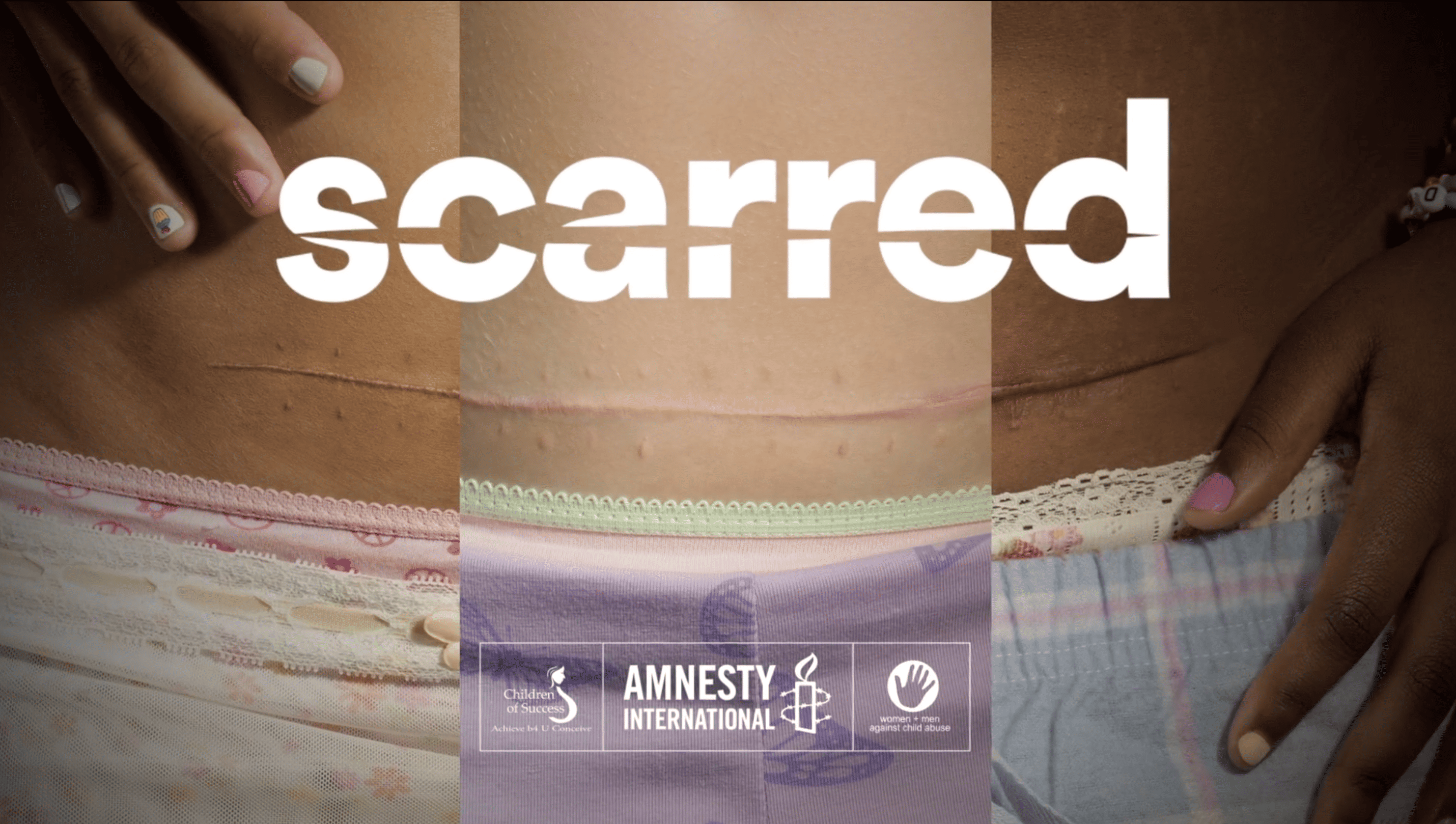 Amnesty International | Scarred case study