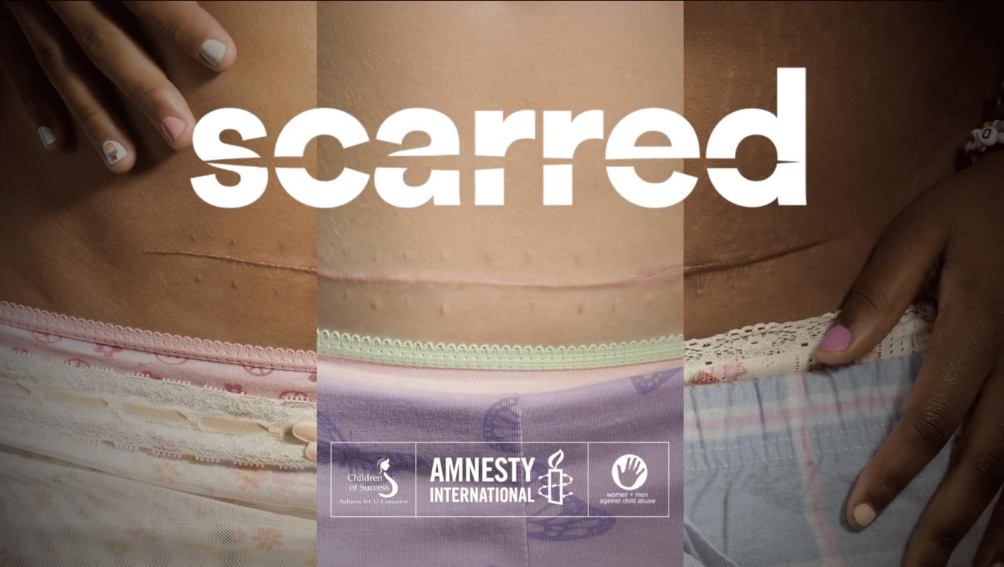 Amnesty International | Scarred case study